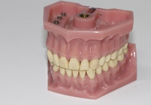 Tænder